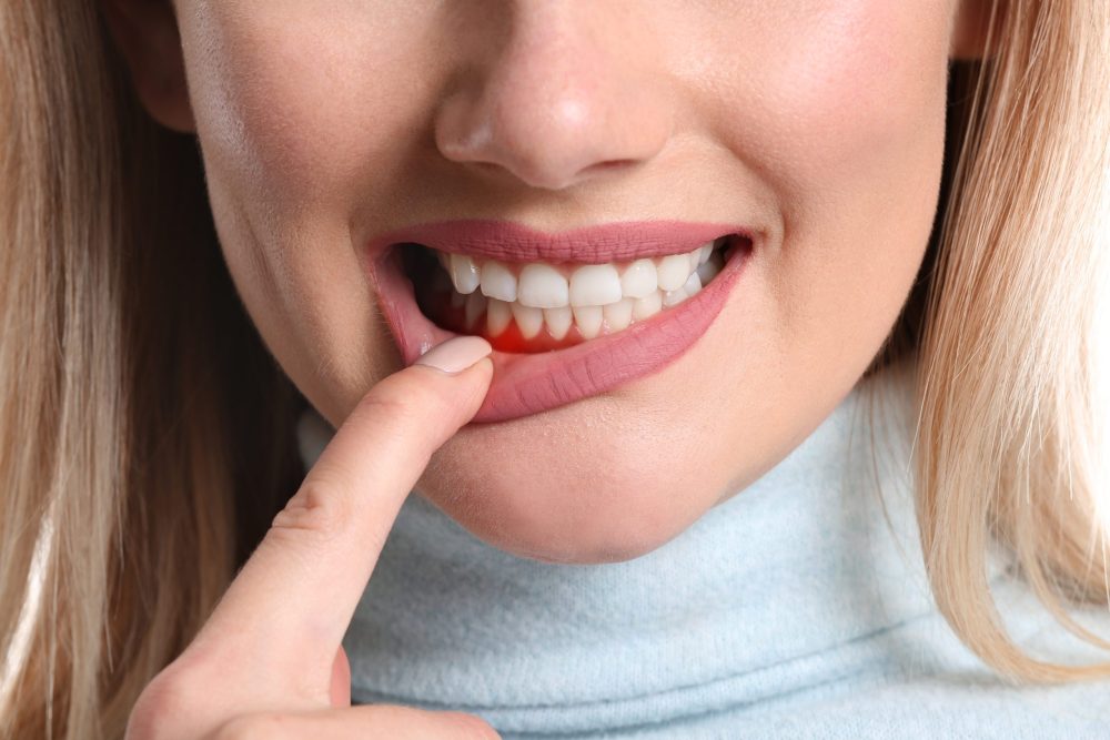 Gum Disease Specialist Glendale and Parker